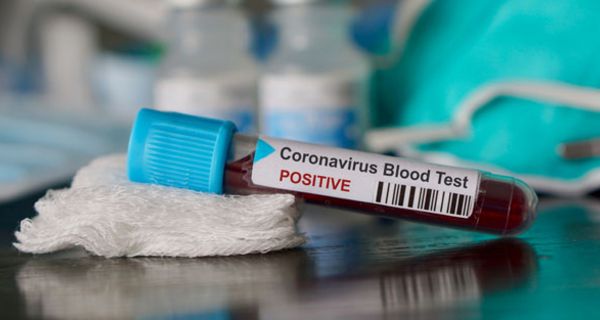 Vier Erkrankungsfälle des Coronavirus sind bekannt.