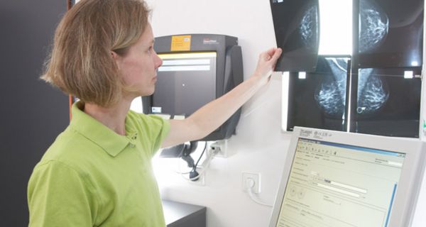 Ärztin betrachtet Mammographie-Bild.