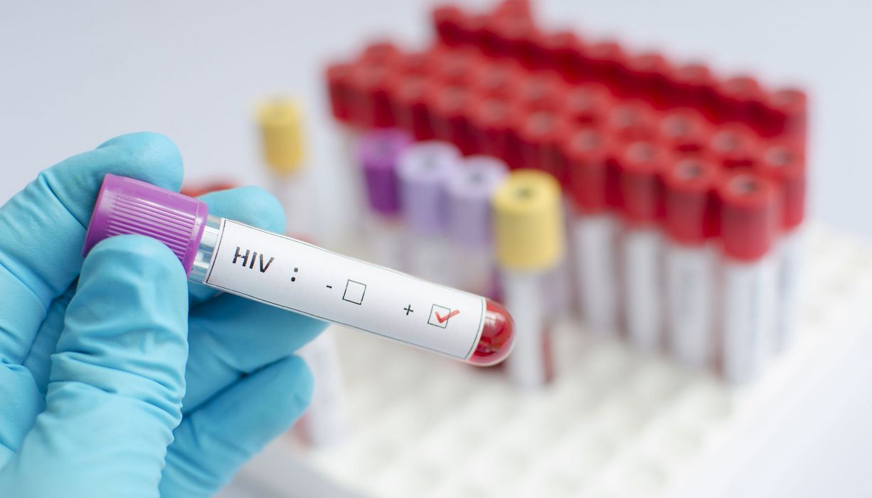 Blutröhrchen mit HIV-Test.