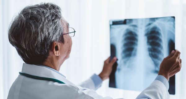 Arzt betrachtet Röntgenaufnahme der Lunge.