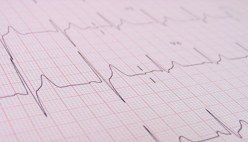 EKG-Kurve auf Millimeterpapier aufgezeichnet.