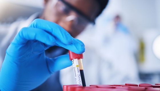 Röhrchen mit Blutprobe.