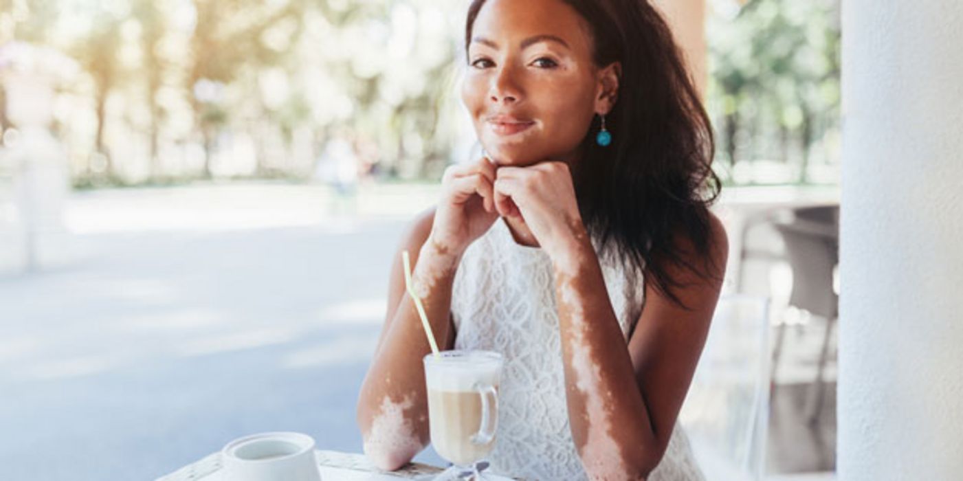 Die Haut von Vitiligo-Patienten ist besonders empfindlich.