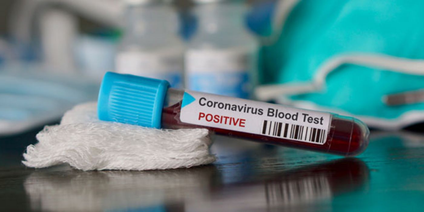 Vier Erkrankungsfälle des Coronavirus sind bekannt.