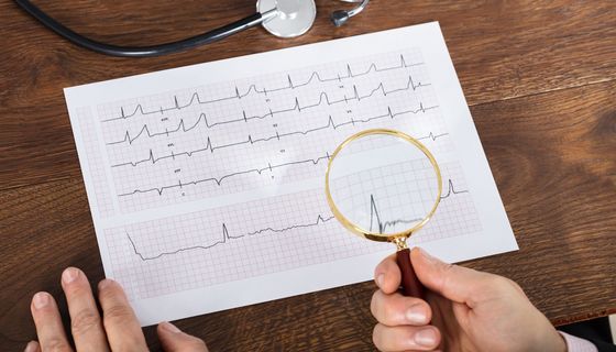 Blatt mit EKG-Kurven.