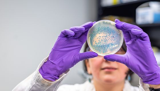 Eine Wissenschaftlerin hält eine Petrischale mit Keimbesiedlung in die Kamera.