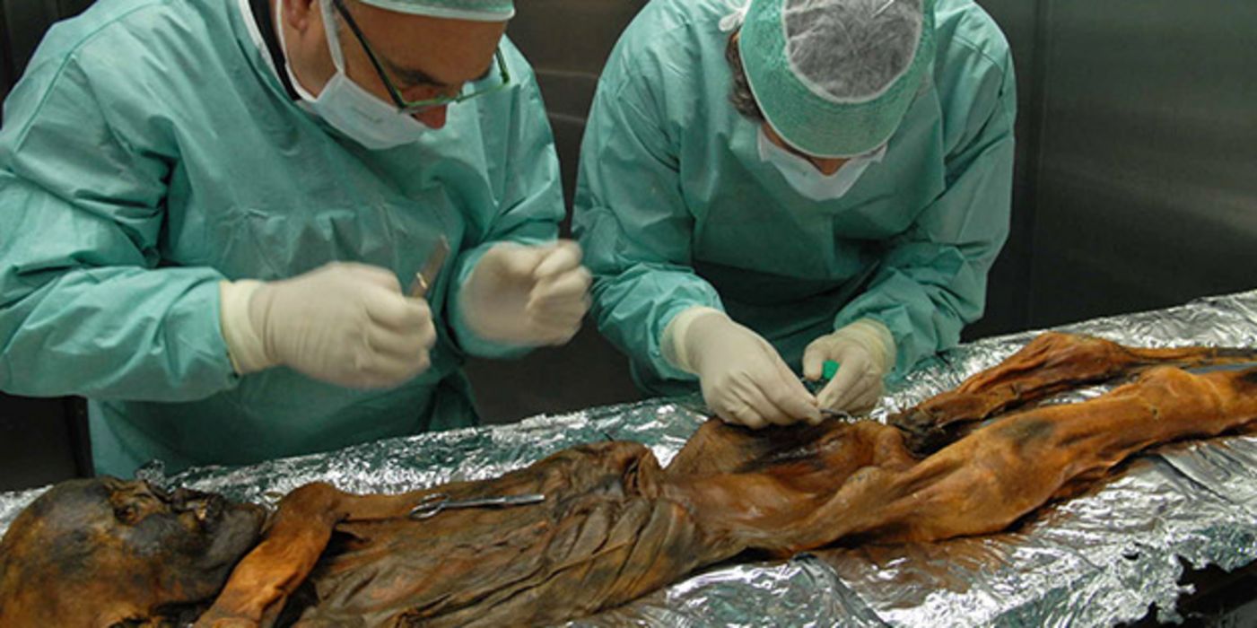 Ein Team internationaler Forscher fand Spuren von Helicobacter pylori in den Überresten des Mageninhalts der Gletschermumie. 