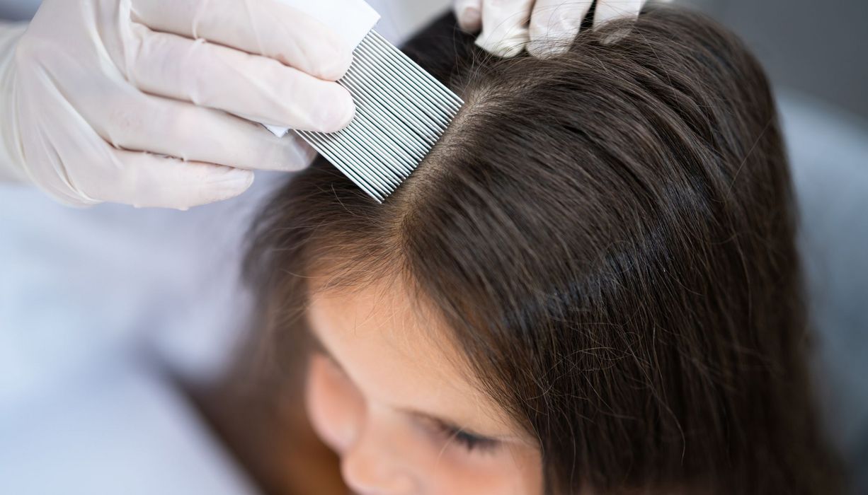 Die Haare eines dunkelhaarigen Mädchens werden mit einem Nissenkamm ausgekämmt.