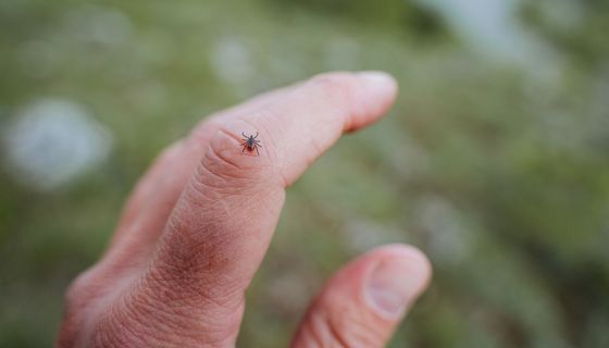 Zecke, sitzt auf dem Finger eines Mannes.