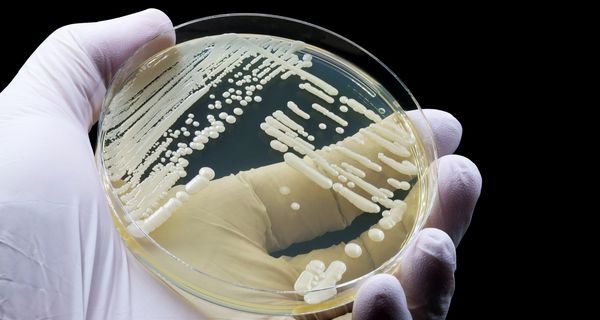 Hand eines Arztes oder Wissenschaftlers, der eine mikrobiologische Kultur des Hefepilzes Candida auris zeigt.